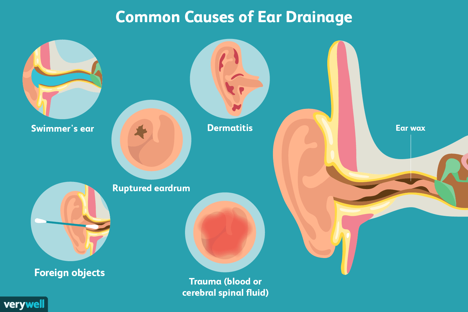 Ear pain/discharge